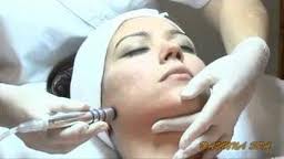 acne_treatment_manhattan_nyc_
